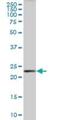 Phospholipase A And Acyltransferase 3 antibody, H00011145-B01P, Novus Biologicals, Western Blot image 