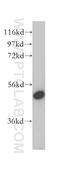 Vacuolar Protein Sorting 4 Homolog B antibody, 17673-1-AP, Proteintech Group, Western Blot image 