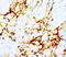 Tenascin C antibody, LS-C171285, Lifespan Biosciences, Immunohistochemistry frozen image 