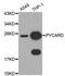 PYD And CARD Domain Containing antibody, A11433, ABclonal Technology, Western Blot image 