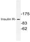 INSR antibody, AP21114PU-N, Origene, Western Blot image 