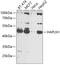 Hyaluronan And Proteoglycan Link Protein 1 antibody, 14-417, ProSci, Western Blot image 