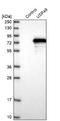 Ubiquitin carboxyl-terminal hydrolase 49 antibody, NBP1-81174, Novus Biologicals, Western Blot image 