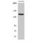 ATP Binding Cassette Subfamily C Member 10 antibody, LS-C384617, Lifespan Biosciences, Western Blot image 