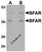 Bifunctional Apoptosis Regulator antibody, 5591, ProSci Inc, Western Blot image 