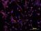 Down syndrome cell adhesion molecule antibody, MA5-24134, Invitrogen Antibodies, Immunocytochemistry image 