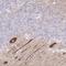 Zinc Finger Protein 281 antibody, NBP2-13564, Novus Biologicals, Immunohistochemistry frozen image 