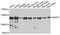Spliceosome Associated Factor 1, Recruiter Of U4/U6.U5 Tri-SnRNP antibody, A05414, Boster Biological Technology, Western Blot image 