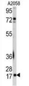 Ubiquitin Conjugating Enzyme E2 I antibody, MBS626003, MyBioSource, Western Blot image 