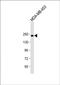 ATR Serine/Threonine Kinase antibody, orb345594, Biorbyt, Western Blot image 