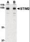 Stromal Interaction Molecule 2 antibody, orb87244, Biorbyt, Western Blot image 