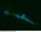TEK Receptor Tyrosine Kinase antibody, 10700-MM07, Sino Biological, Immunohistochemistry frozen image 