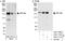 Zinc finger protein 198 antibody, A301-711A, Bethyl Labs, Immunoprecipitation image 
