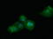 Short Chain Dehydrogenase/Reductase Family 9C Member 7 antibody, LS-C172392, Lifespan Biosciences, Immunofluorescence image 