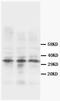 CNN1 antibody, AM20594PU-N, Origene, Western Blot image 