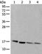 Ubiquitin Conjugating Enzyme E2 D3 antibody, PA5-67548, Invitrogen Antibodies, Western Blot image 