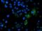 Mitochondrial Intermediate Peptidase antibody, MA5-26412, Invitrogen Antibodies, Immunocytochemistry image 