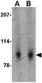 SLIT And NTRK Like Family Member 2 antibody, GTX17000, GeneTex, Western Blot image 