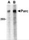 Cullin 9 antibody, 3171, ProSci, Western Blot image 