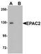 Rap Guanine Nucleotide Exchange Factor 4 antibody, TA319831, Origene, Western Blot image 
