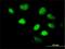 LIM Homeobox 5 antibody, H00064211-M05, Novus Biologicals, Immunocytochemistry image 
