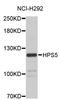 HPS5 Biogenesis Of Lysosomal Organelles Complex 2 Subunit 2 antibody, STJ26694, St John