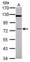3'-Phosphoadenosine 5'-Phosphosulfate Synthase 1 antibody, NBP2-19692, Novus Biologicals, Western Blot image 