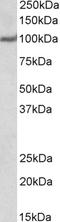 Ubiquitin carboxyl-terminal hydrolase 4 antibody, EB05972, Everest Biotech, Western Blot image 