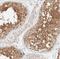 Choline Kinase Alpha antibody, NBP1-85630, Novus Biologicals, Immunohistochemistry frozen image 