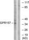 G Protein-Coupled Receptor 157 antibody, TA315821, Origene, Western Blot image 