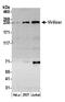 Vir Like M6A Methyltransferase Associated antibody, A302-124A, Bethyl Labs, Western Blot image 