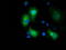 E3 ubiquitin-protein ligase MGRN1 antibody, TA502680, Origene, Immunofluorescence image 