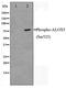 Arachidonate 5-lipoxygenase antibody, TA348442, Origene, Western Blot image 