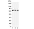 DEAD-Box Helicase 4 antibody, R31067, NSJ Bioreagents, Western Blot image 