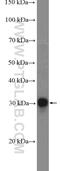 HLA-DQA1 antibody, 16918-1-AP, Proteintech Group, Western Blot image 