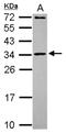Mitochondrial Ribosomal Protein L10 antibody, NBP2-19395, Novus Biologicals, Western Blot image 