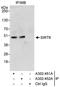 Sirtuin 6 antibody, A302-451A, Bethyl Labs, Immunoprecipitation image 