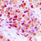 Splicing Factor 1 antibody, GTX55031, GeneTex, Immunohistochemistry paraffin image 