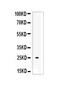 Endothelial Cell Specific Molecule 1 antibody, PA5-79221, Invitrogen Antibodies, Western Blot image 