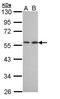 Dipeptidyl Peptidase 7 antibody, GTX108734, GeneTex, Western Blot image 