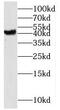 Membrane Spanning 4-Domains A6A antibody, FNab05369, FineTest, Western Blot image 