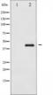 SMAD Family Member 3 antibody, TA325854, Origene, Western Blot image 