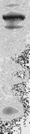 Myosin Heavy Chain 6 antibody, TA354809, Origene, Western Blot image 
