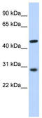 Pygopus homolog 2 antibody, TA339157, Origene, Western Blot image 