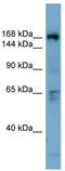 Dedicator of cytokinesis protein 2 antibody, TA340057, Origene, Western Blot image 
