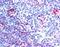 Neuroepithelial Cell Transforming 1 antibody, MBS421447, MyBioSource, Immunohistochemistry paraffin image 