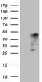 Troponin T2, Cardiac Type antibody, CF807841, Origene, Western Blot image 