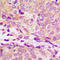 Heat shock protein HSP 90-alpha antibody, LS-C352335, Lifespan Biosciences, Immunohistochemistry paraffin image 