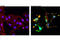 Caspase 3 antibody, 9603S, Cell Signaling Technology, Immunocytochemistry image 
