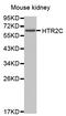 5-Hydroxytryptamine Receptor 2C antibody, abx135719, Abbexa, Western Blot image 